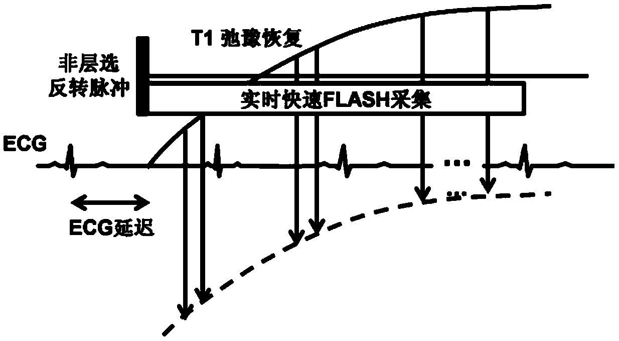 Myocardium T1 value measuring method and system