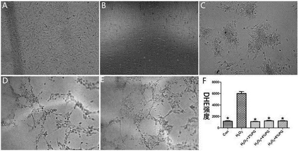 Application of puerarin hydrogel in drug for treating myocardial infarction