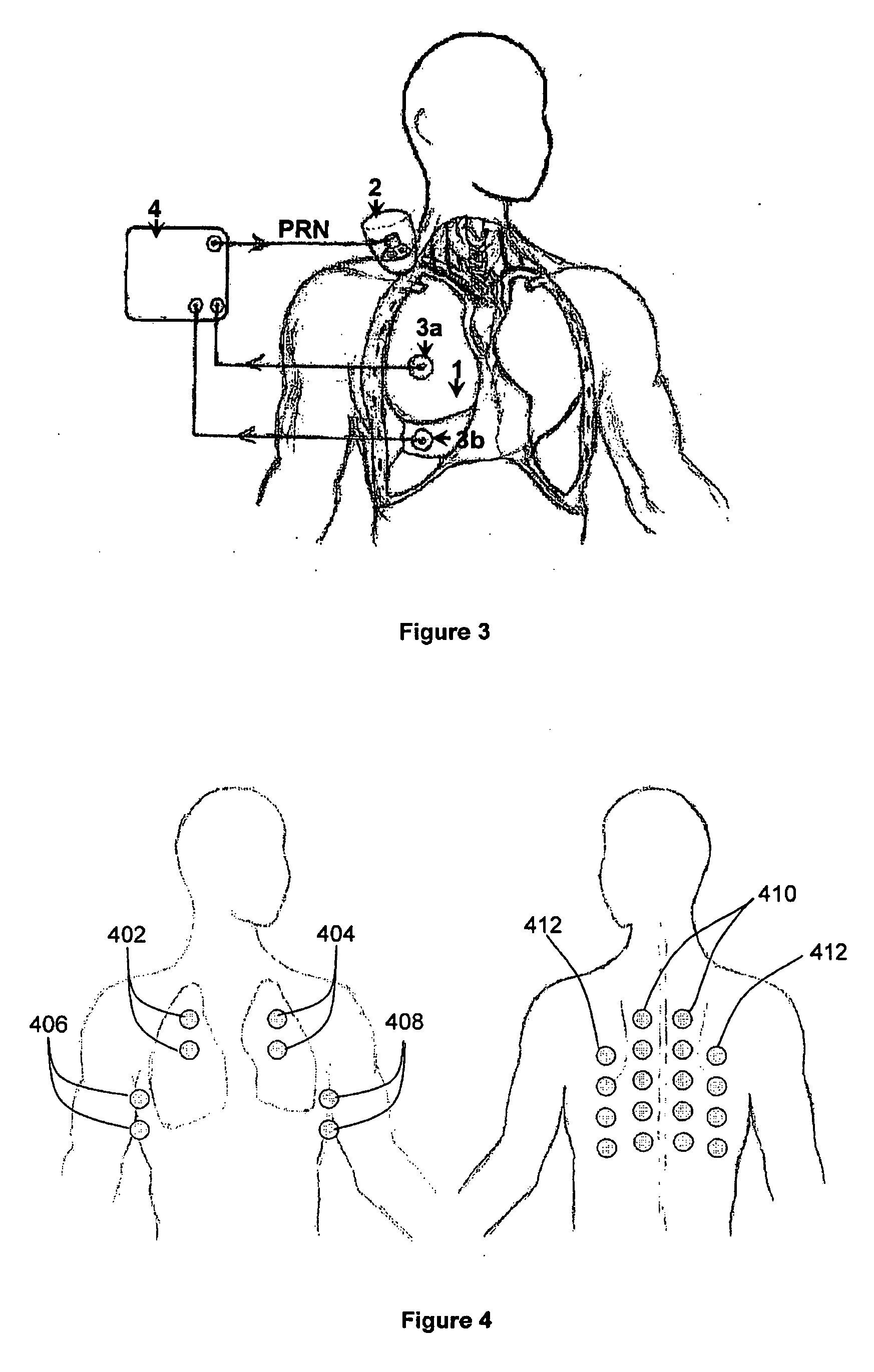 Apparatus and method for lung analysis