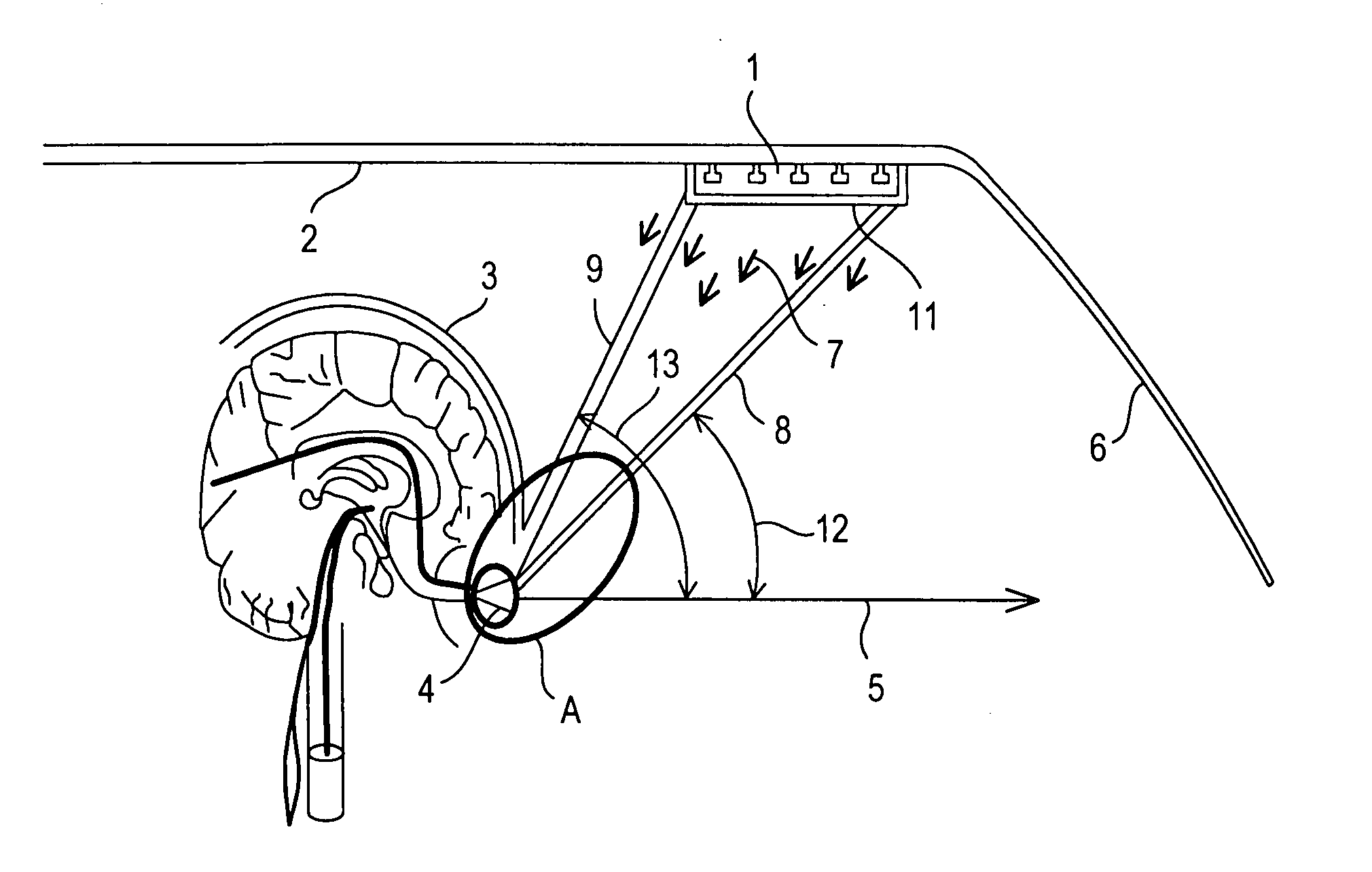 Phototherapy device