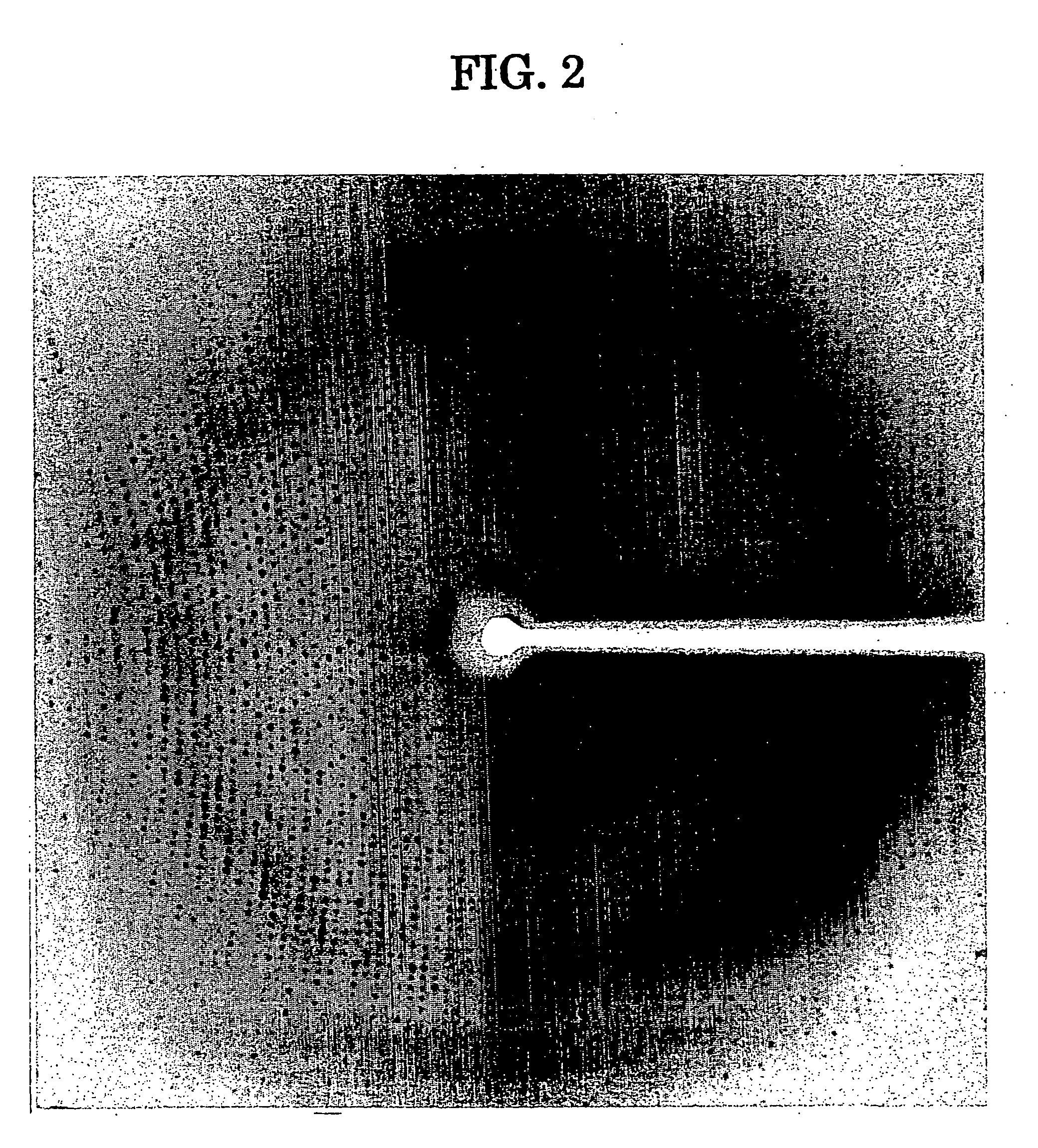 Three-dimensional structure of dipeptidyl peptidase IV