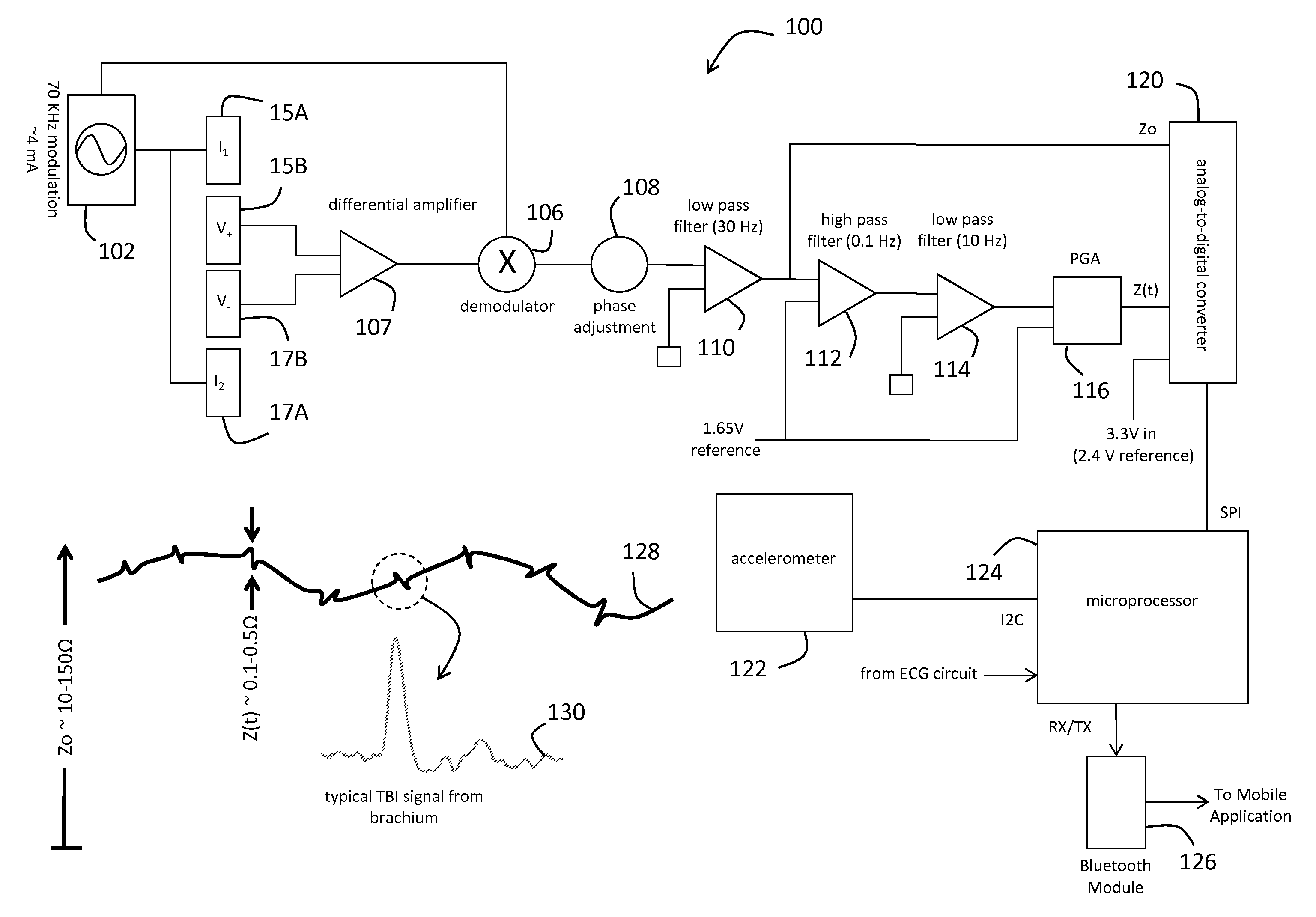 System for electrophysiology that includes software module and body-worn monitor