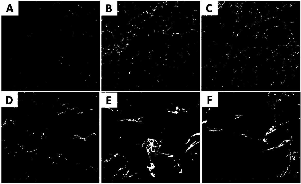 Preparation method of composite bone scaffold material