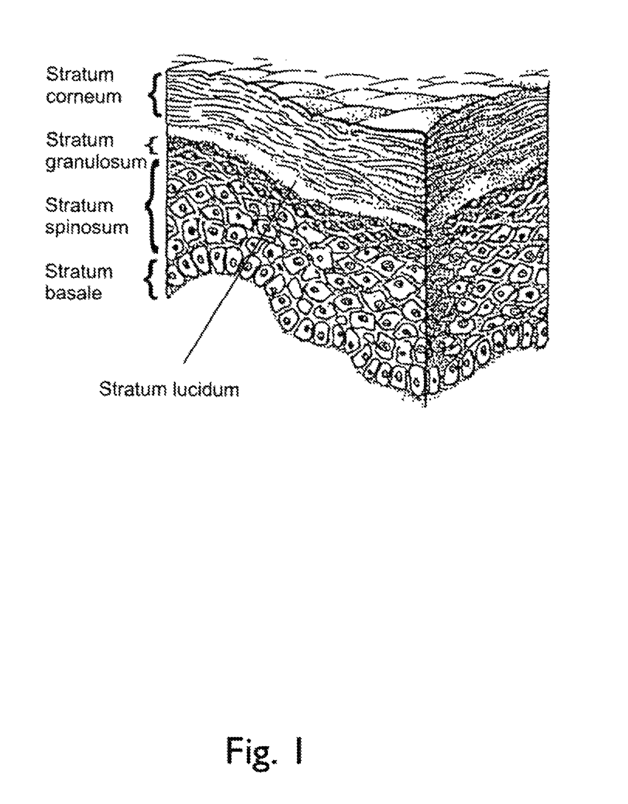 Physiological recording device or electrode