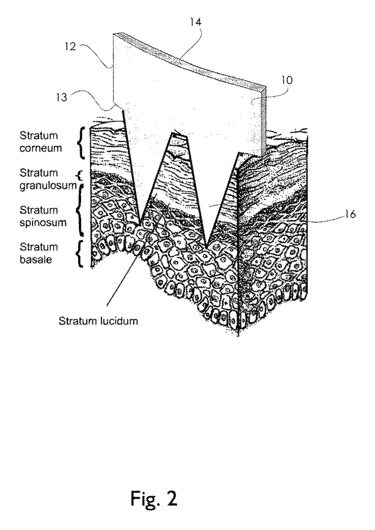 Physiological recording device or electrode