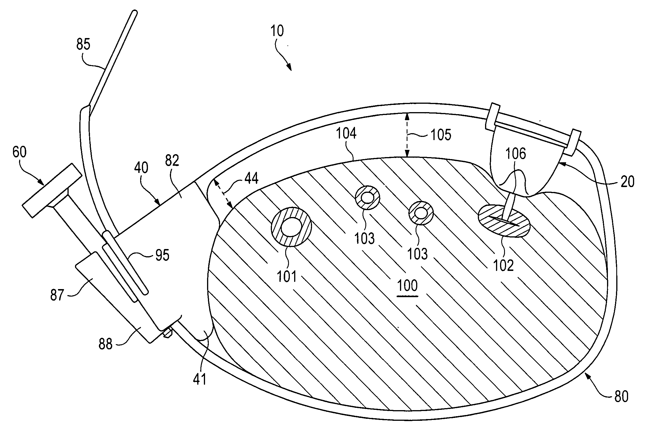 Vascular Compression Apparatus, Pad and Method Of Use