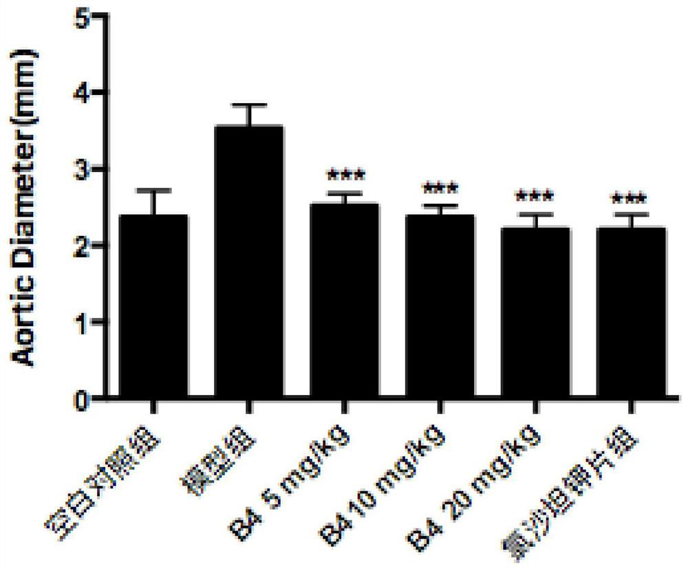 Application of pulsatilla saponin B4 in preparation of antihypertensive drug