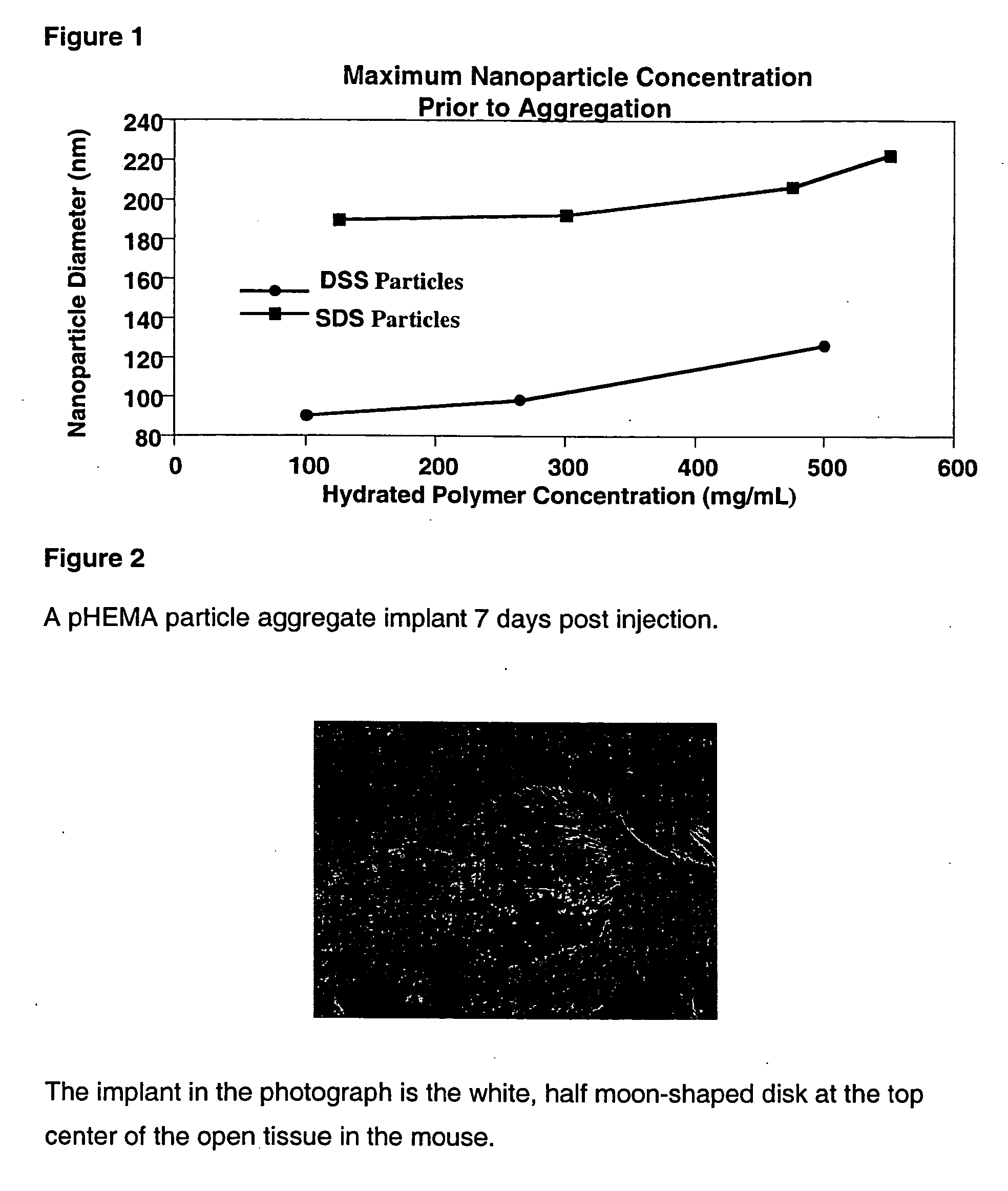 Method of formation of shape-retentive aggregates of gel particles and their uses