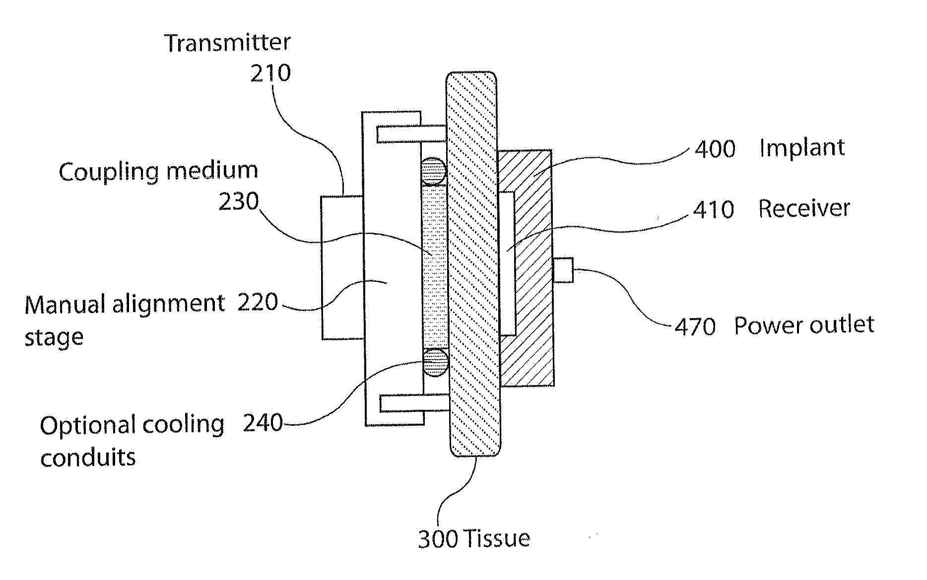 High power ultrasound wireless transcutaneous energy transfer (us-tet) source