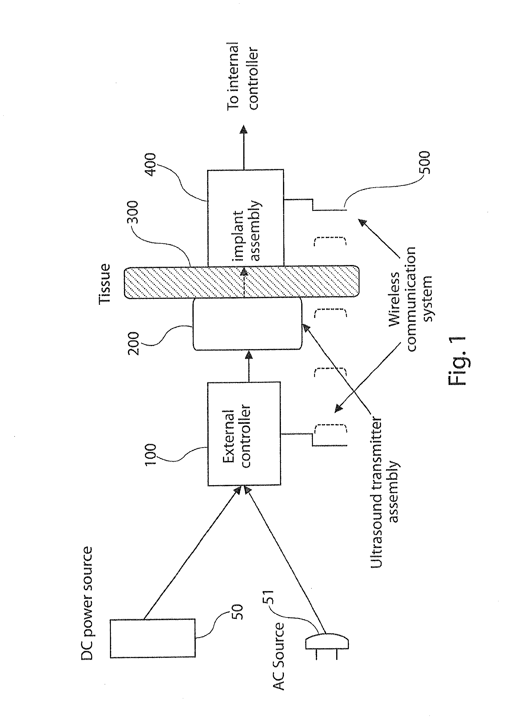 High power ultrasound wireless transcutaneous energy transfer (us-tet) source