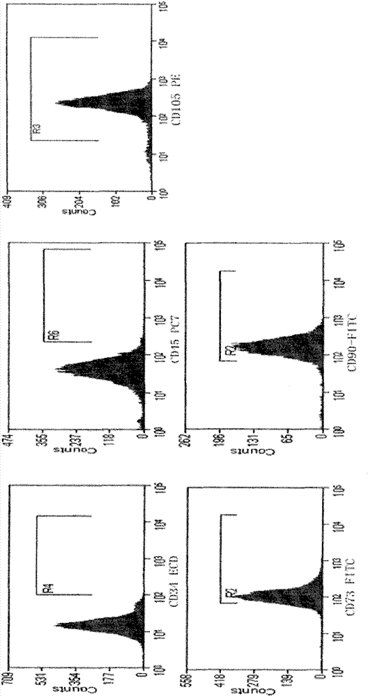 A method for isolating and culturing human olfactory mucosa mesenchymal stem cells