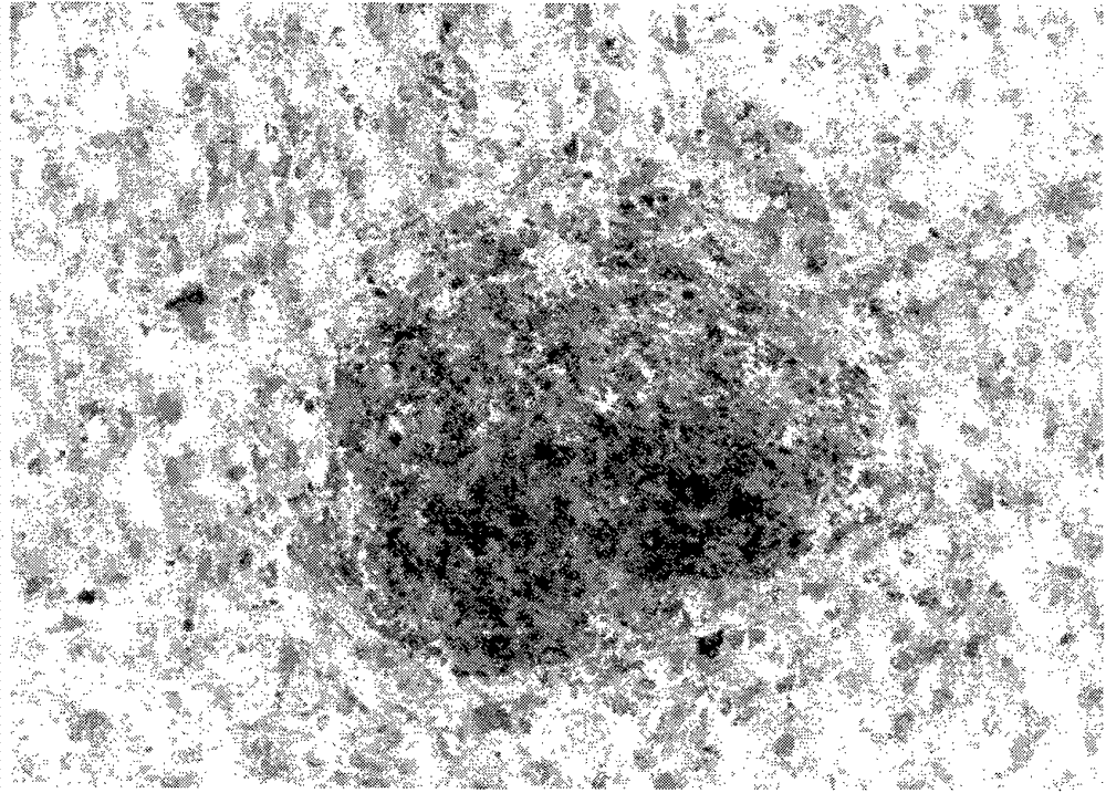 A method for isolating and culturing human olfactory mucosa mesenchymal stem cells