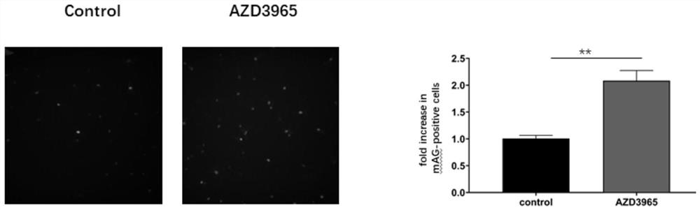 Novel application of AZD3965 medicine