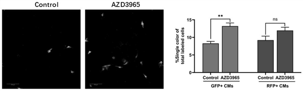 Novel application of AZD3965 medicine