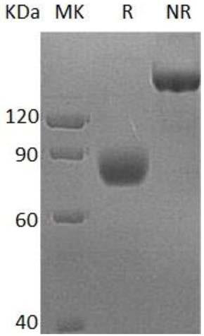 Protein applied to culture of NK cells, culture medium component combination and preparation method