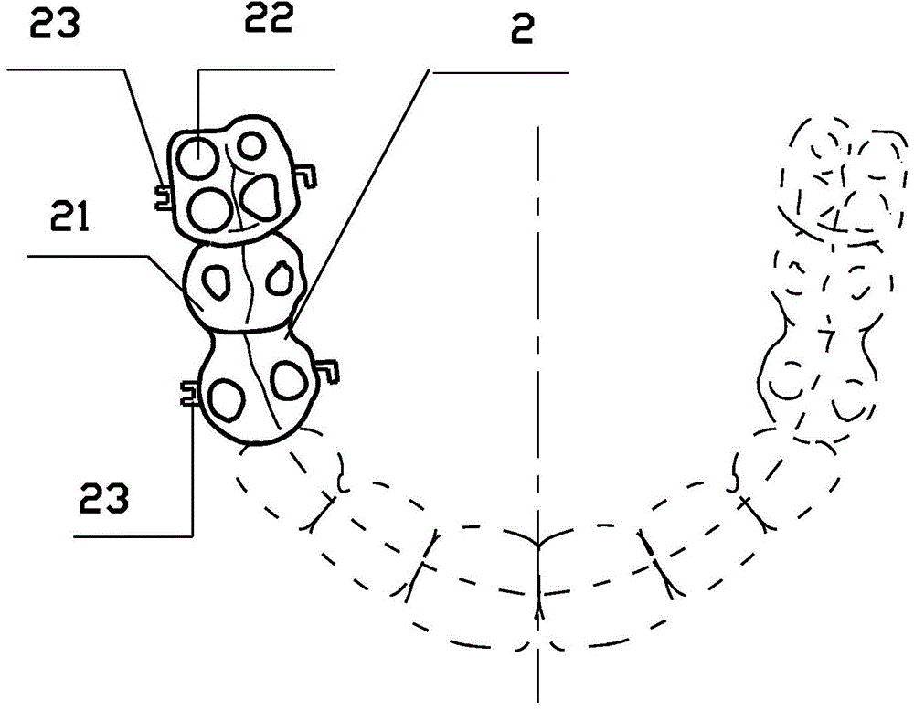 Device for relieving buccal crossbite for fixed type asymmetric occlusal pad combined casting crown