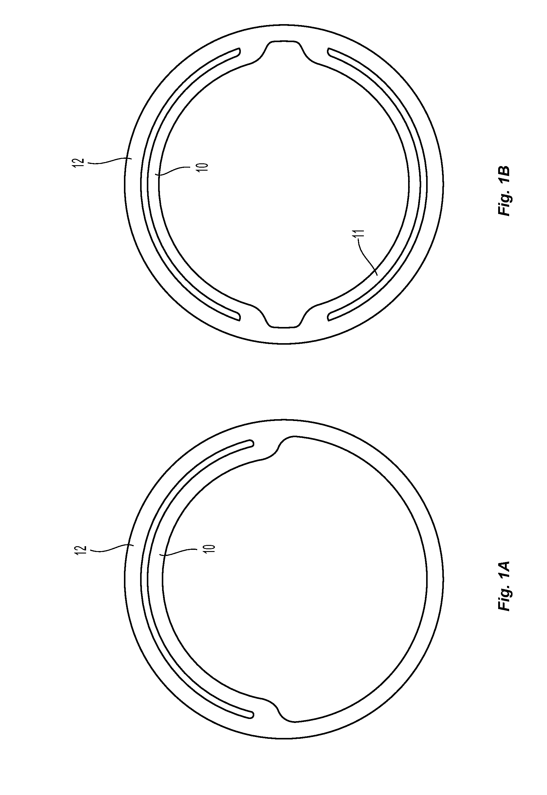 Systems and methods for endoluminal valve creation