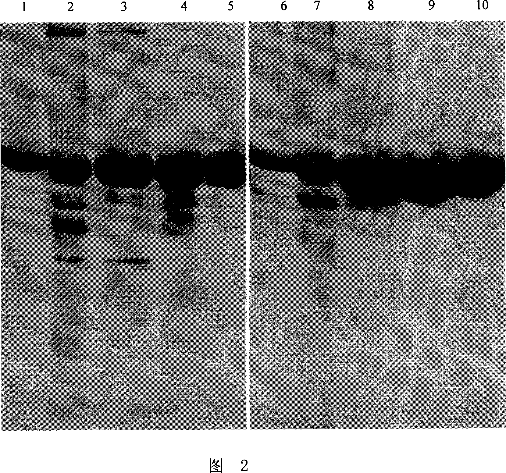 Fusion protein comprised of human serum and interferon and its coding gene and application