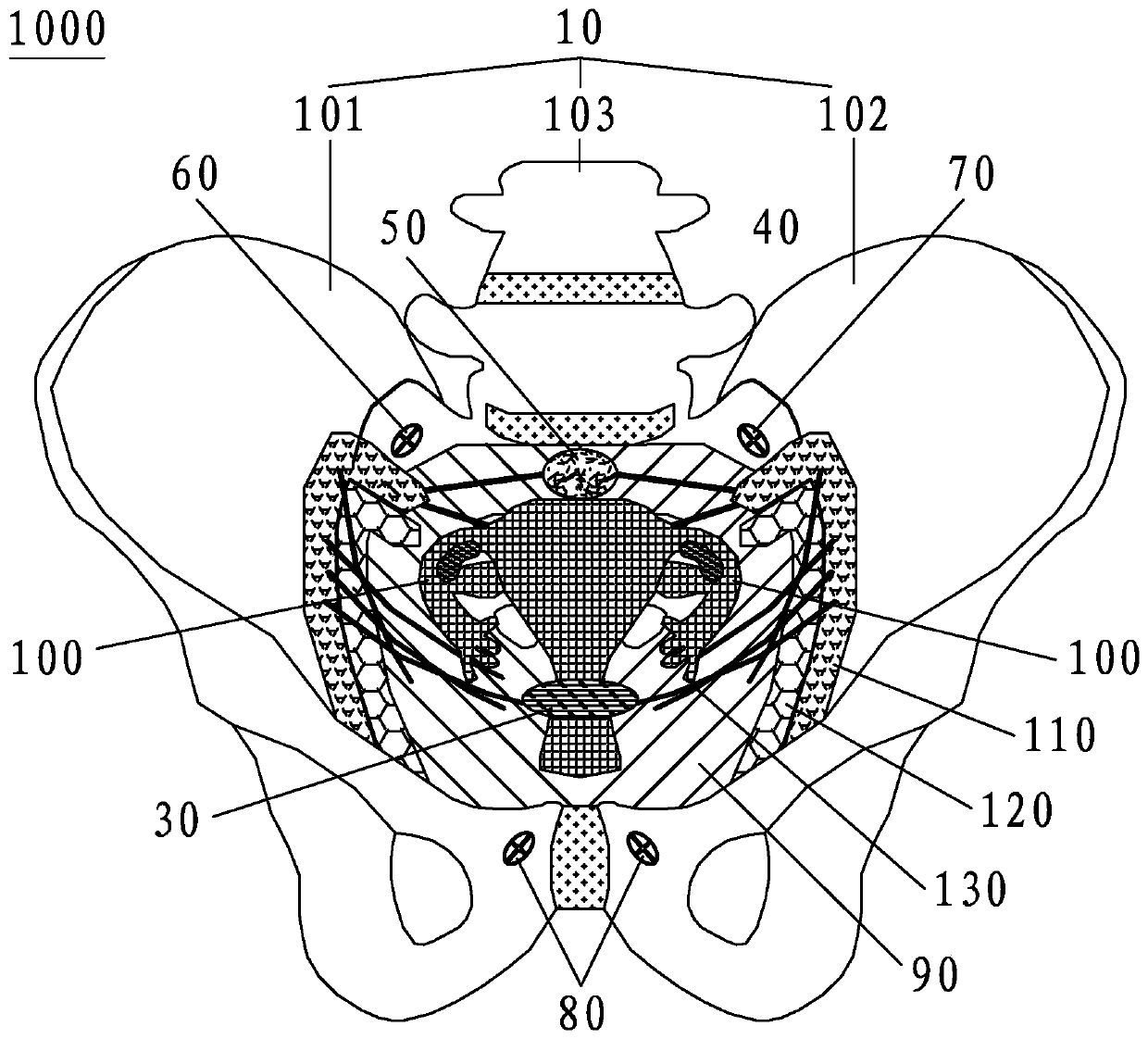 Female reproductive system anatomy teaching aid