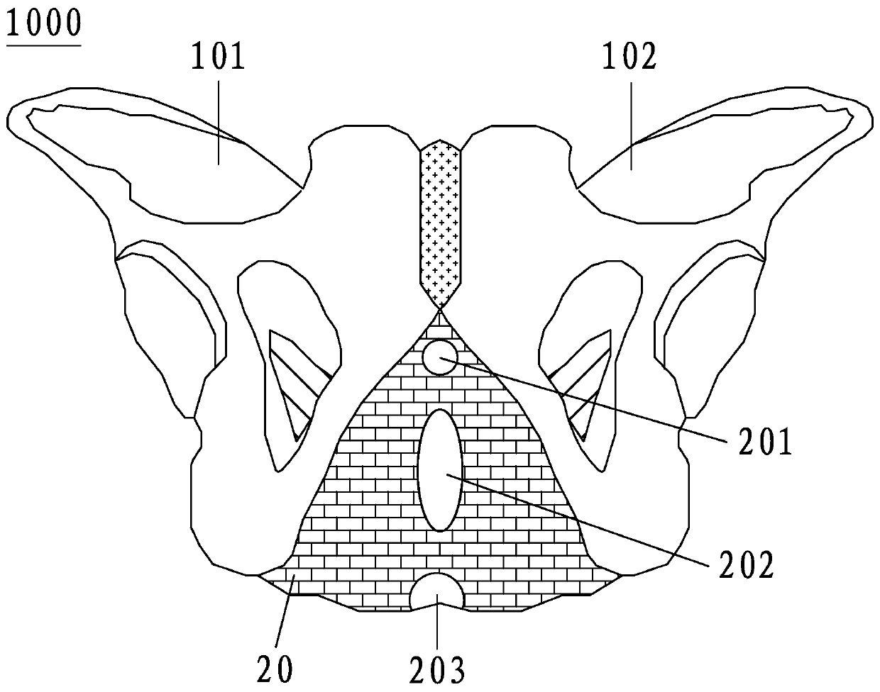 Female reproductive system anatomy teaching aid