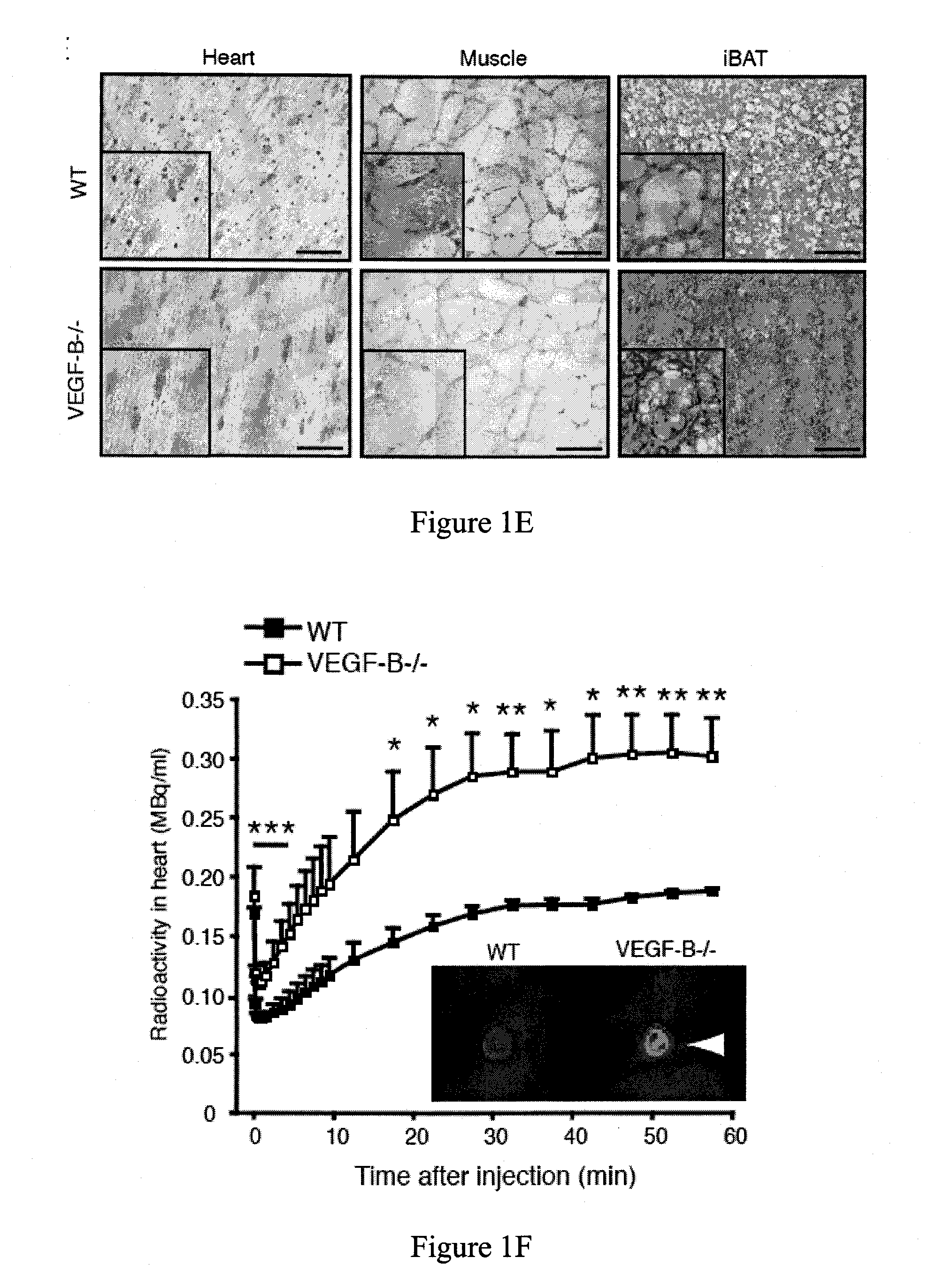 Regulation of fatty acid transporters