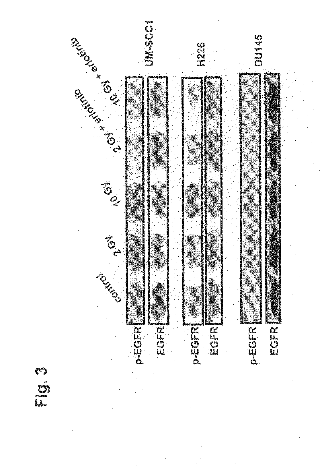 Combined treatment with radiation and an epidermal growth factor receptor kinase inhibitor