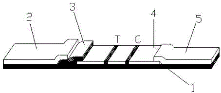 Application of CRISP (cysteine-rich secretory protein)1 kit for diagnosing carcinoma of tongue