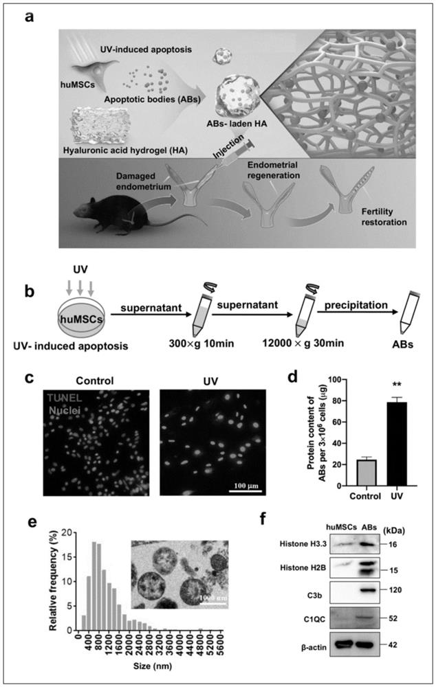 Preparation method of stem cell apoptotic body for repairing endometrium and improving fertility