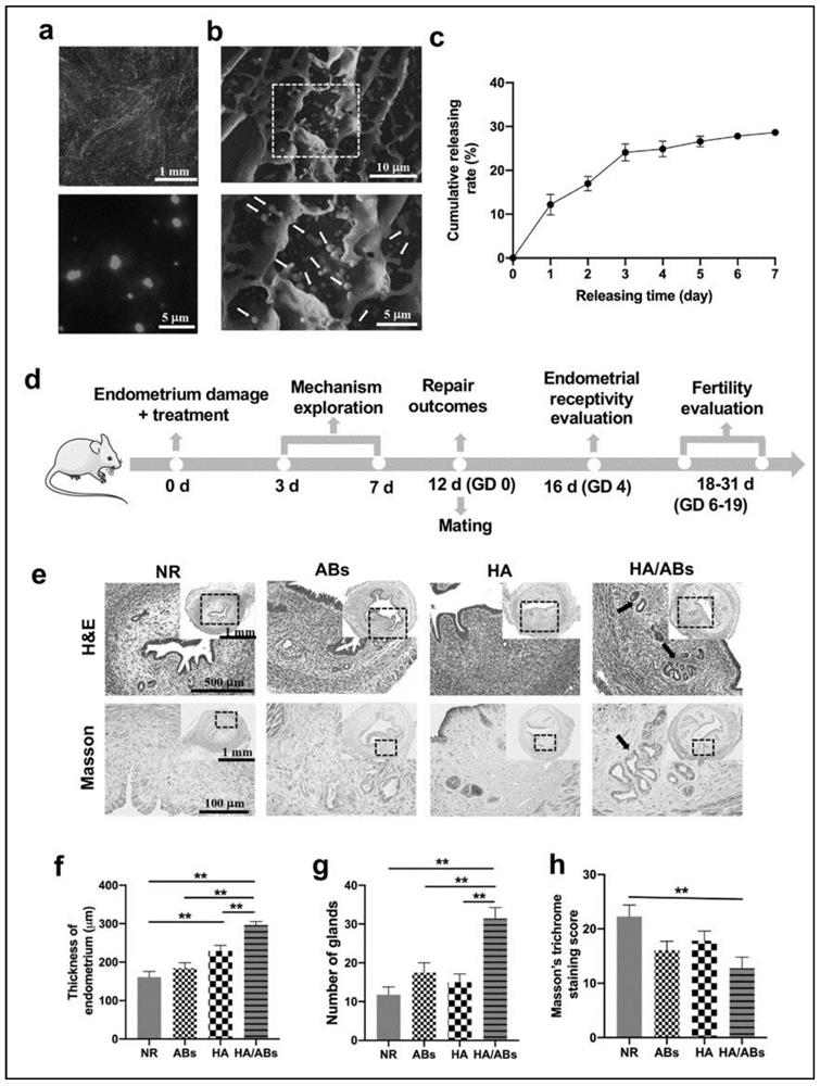 Preparation method of stem cell apoptotic body for repairing endometrium and improving fertility