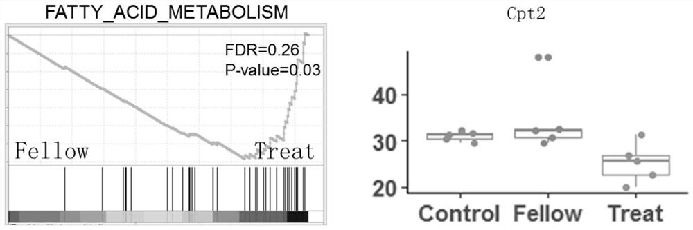 Application of inhibiting myopia by adjusting eye sclera lipid metabolism