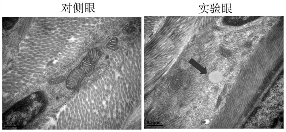 Application of inhibiting myopia by adjusting eye sclera lipid metabolism