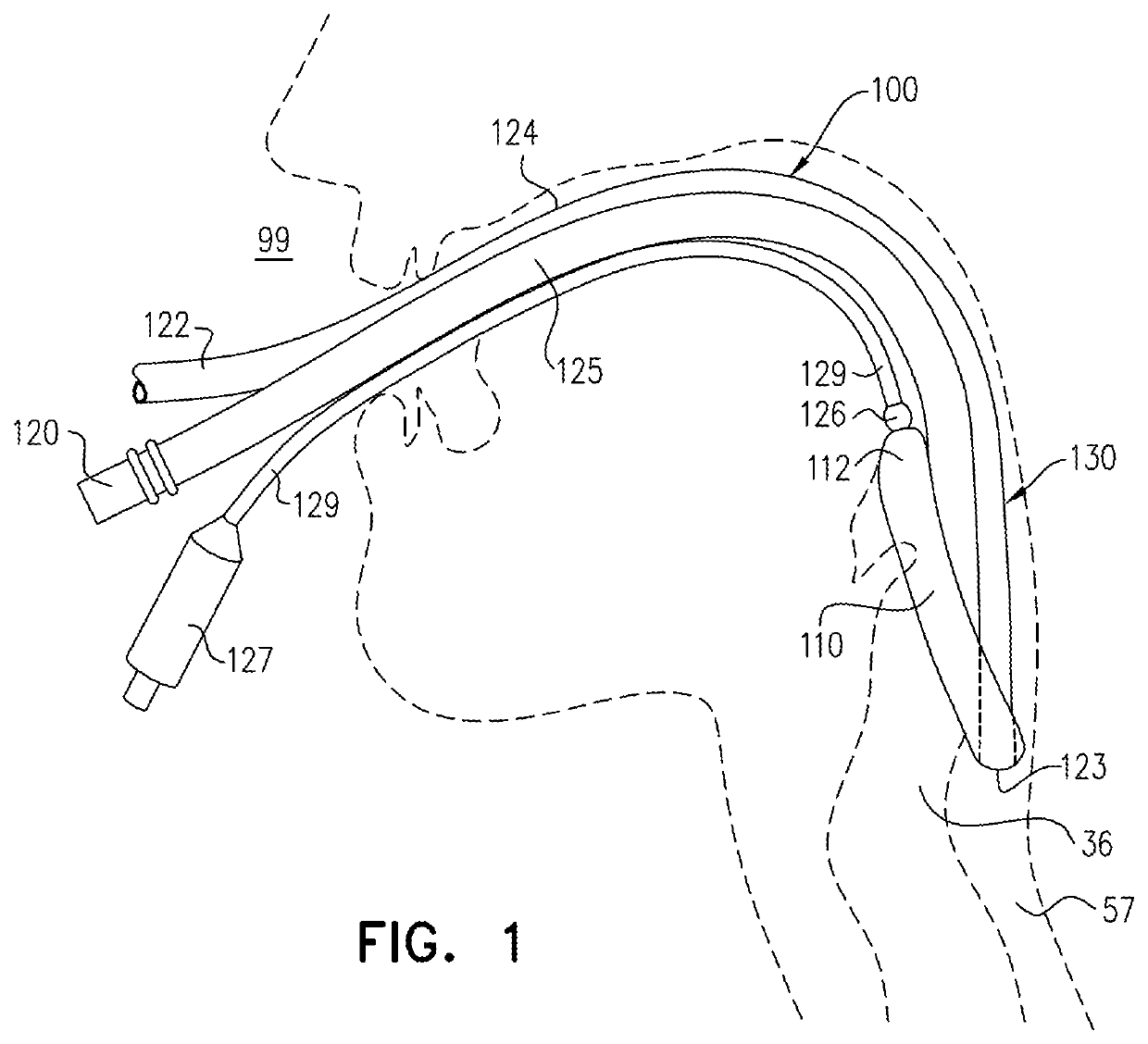 Laryngeal mask cuffs