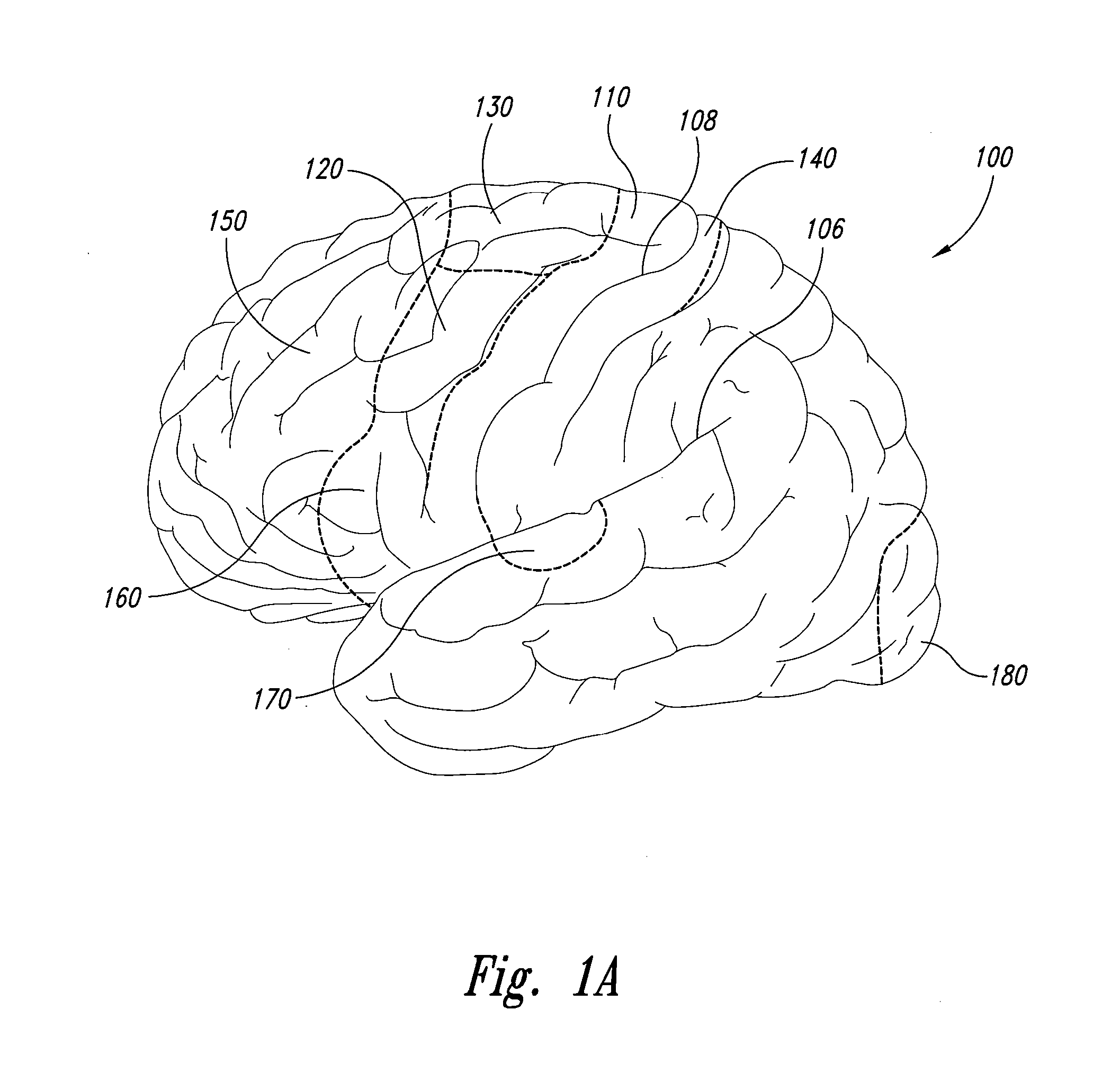 Electrode configurations for reducing invasiveness and/or enhancing neural stimulation efficacy, and associated methods