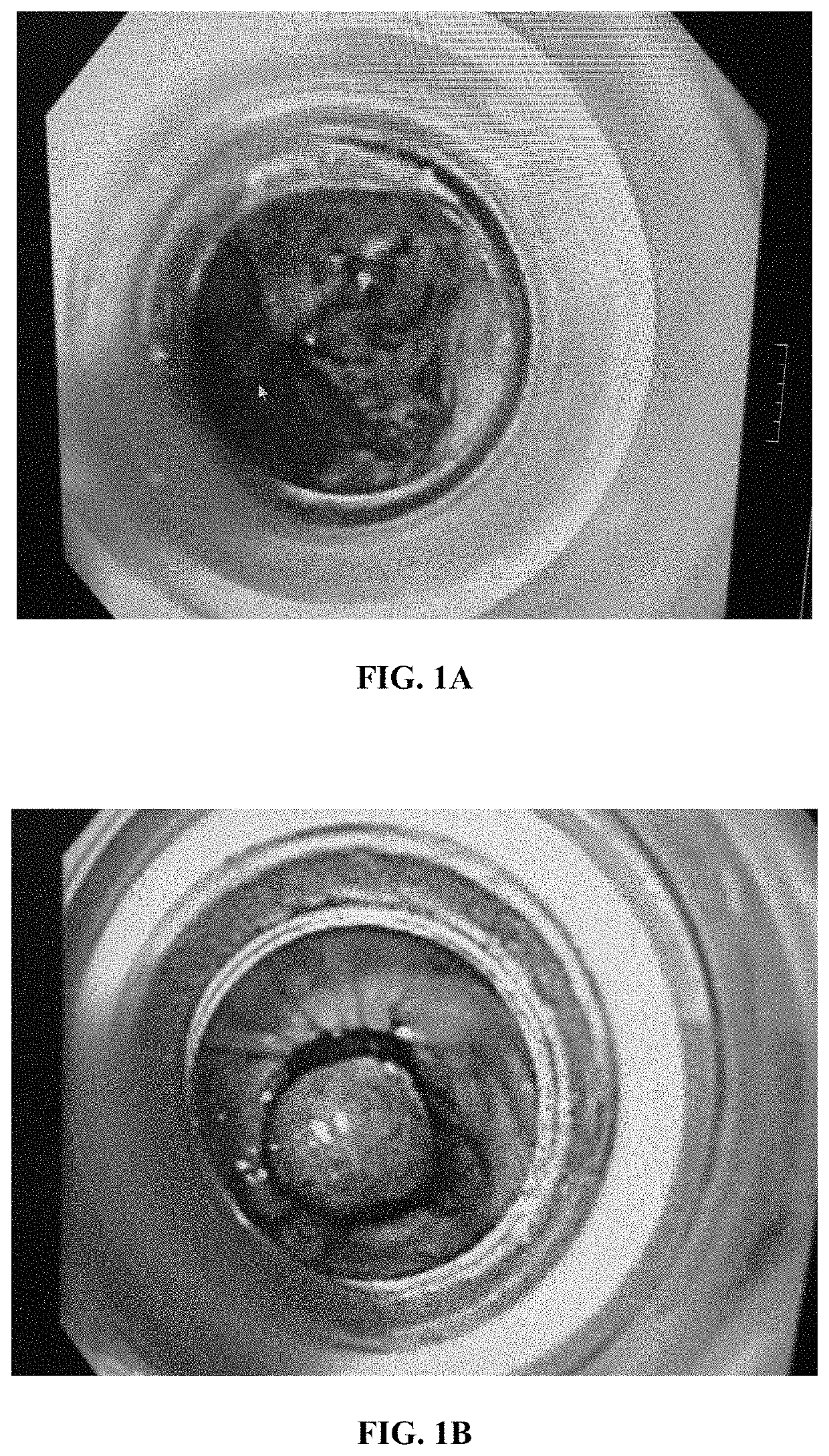 Snare for removing tumor