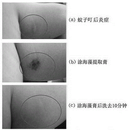 A kind of preparation method of extracting skin anti-inflammation, detumescence and antipruritic ointment from microalgae dregs