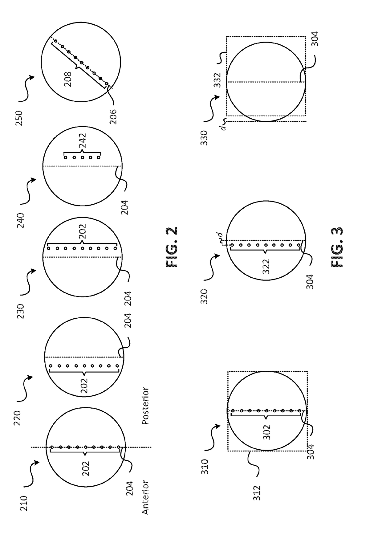 Mid-plane range-probing techniques for particle therapy