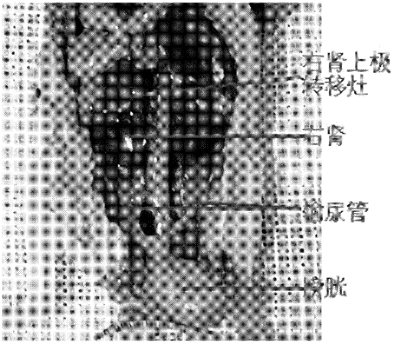 Human bladder cancer cell line