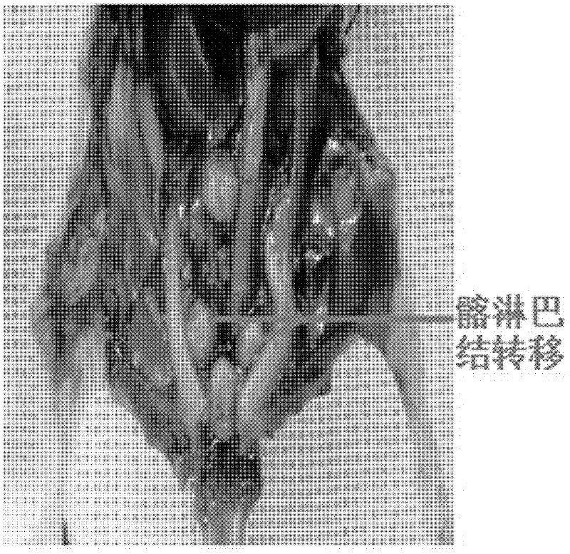 Human bladder cancer cell line