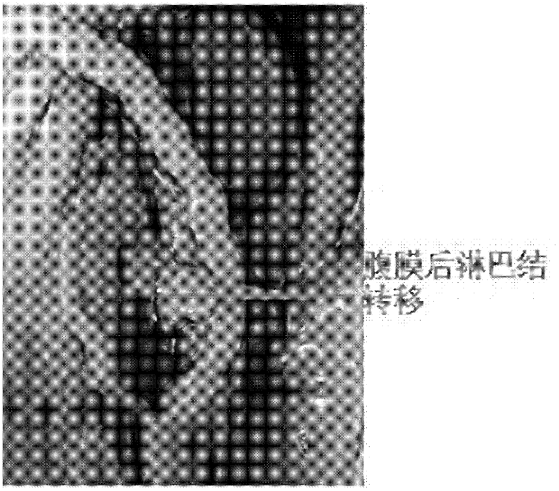 Human bladder cancer cell line