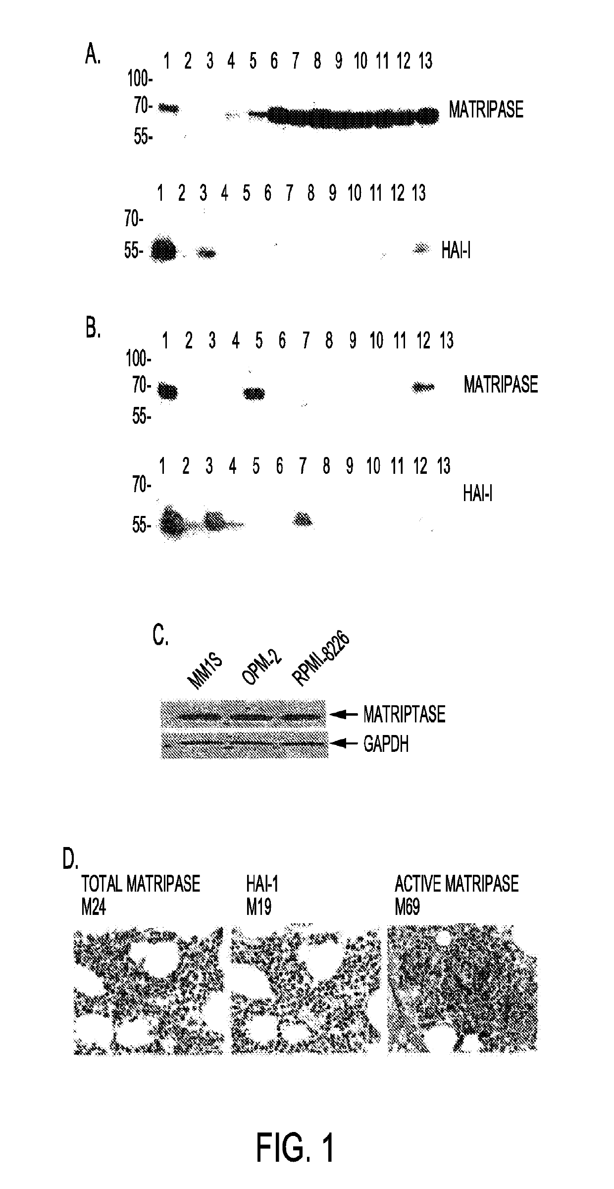 Targeting tumor cells with chemotherapeutic agents conjugated to Anti-matriptase antibodies by in vivo cleavable linking moieties