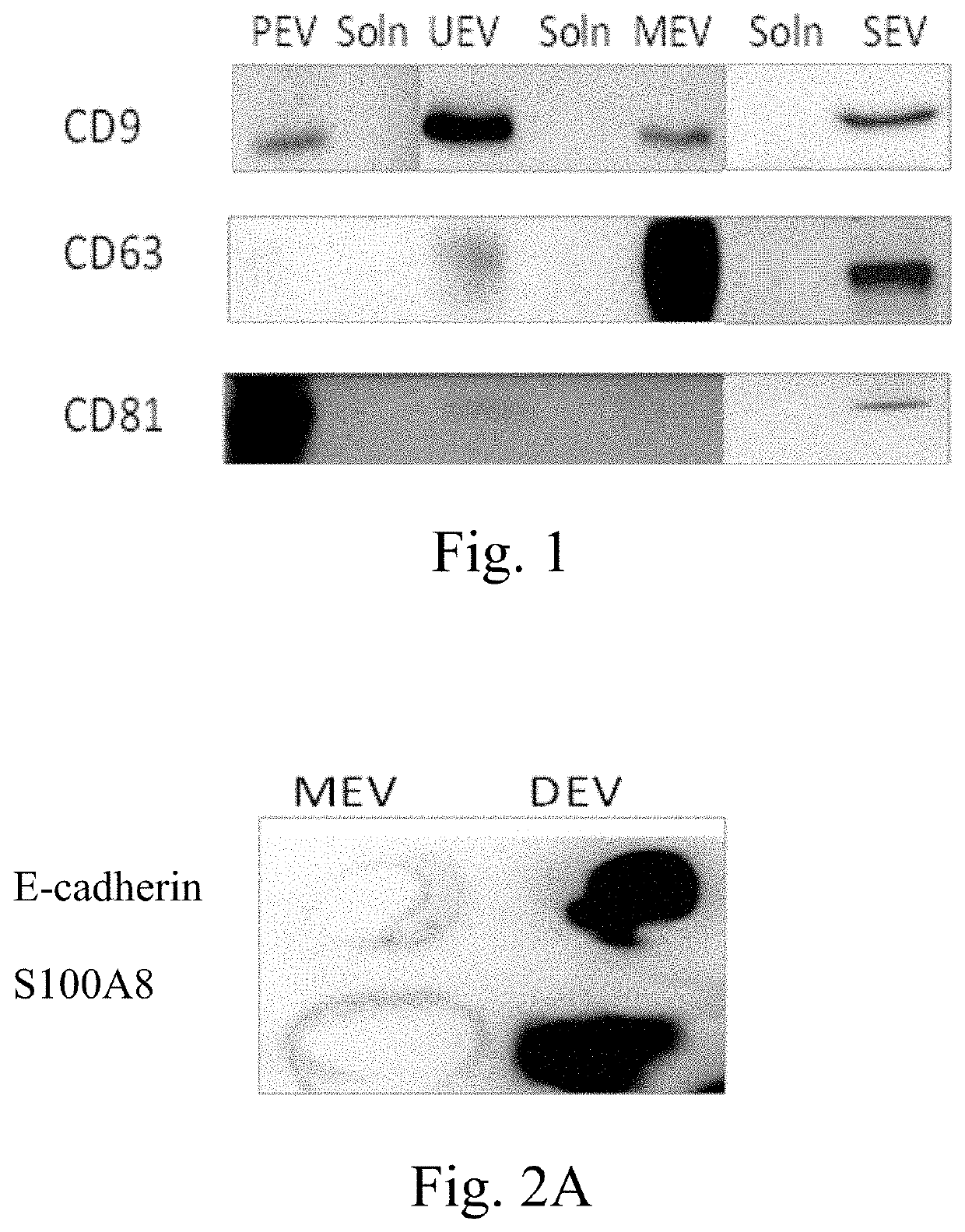 Methods of diagnosing diseases by extracellular vesicles and uses thereof