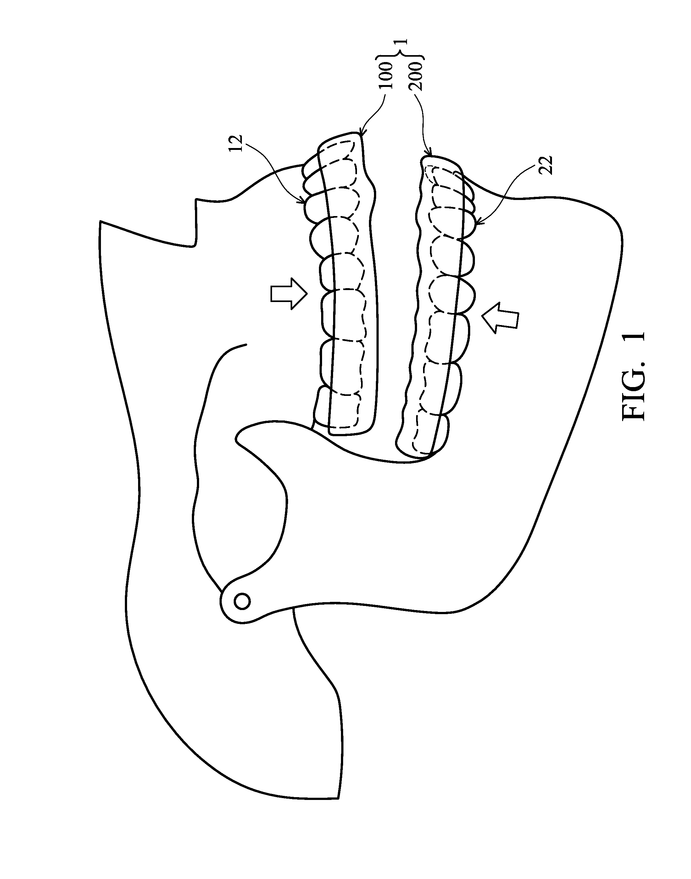 Masticatory orthodontic correction device