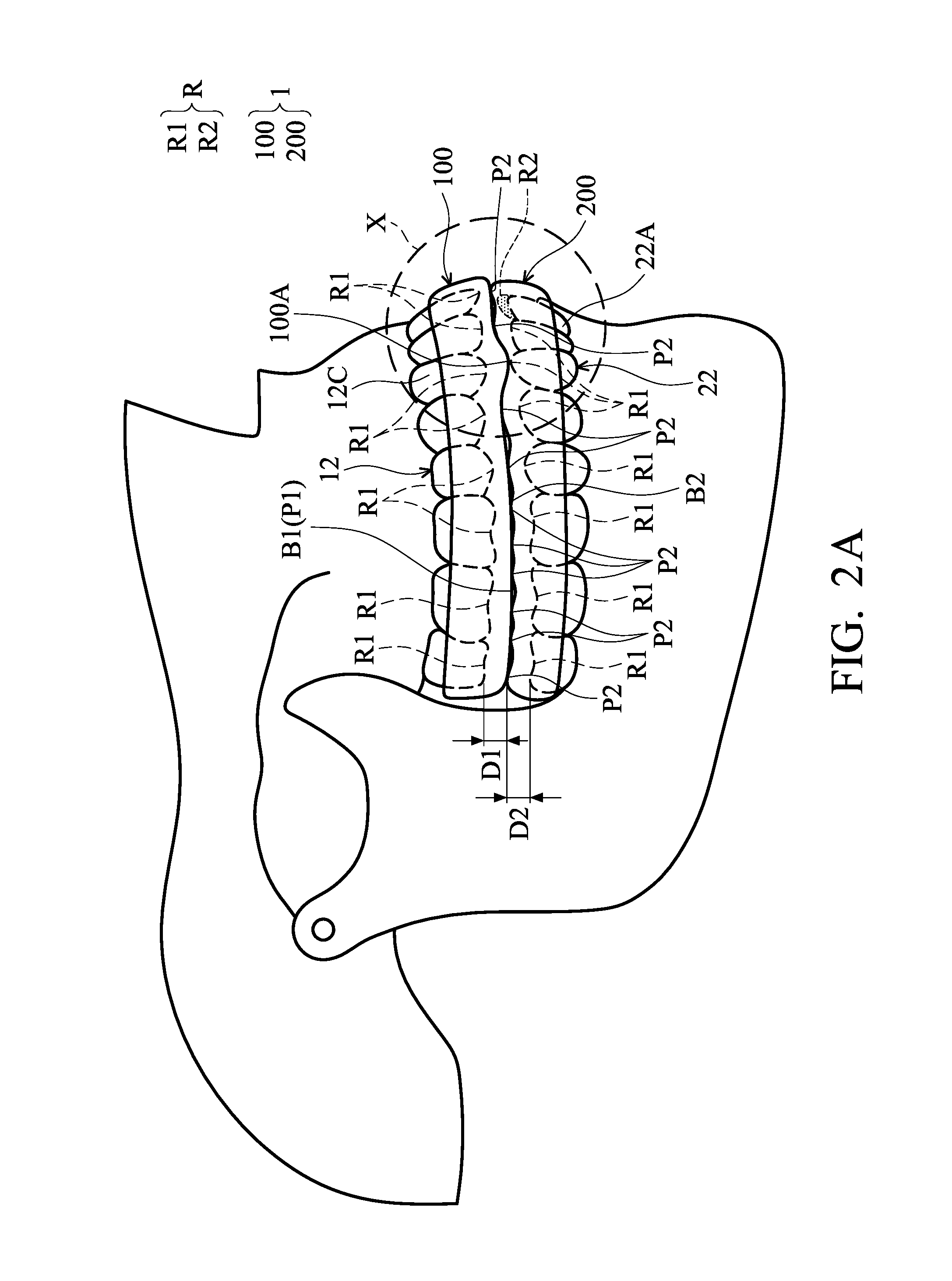 Masticatory orthodontic correction device