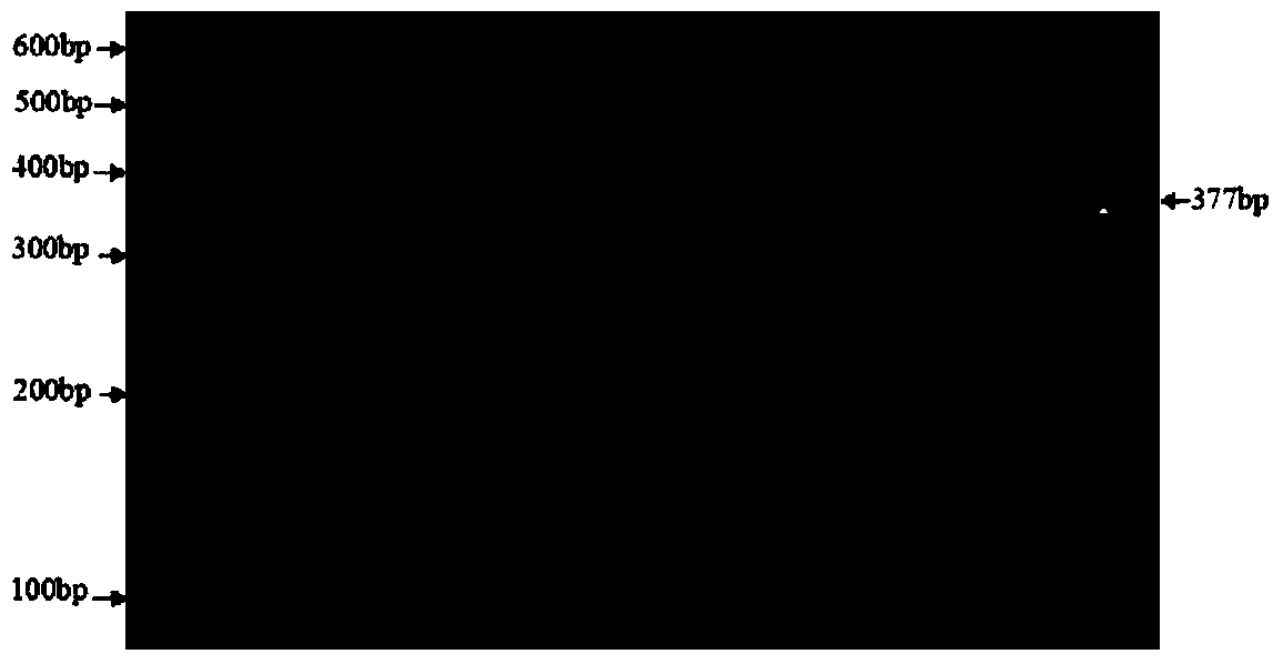 Method for breeding kidding traits by utilizing 3-gene pyramiding effect