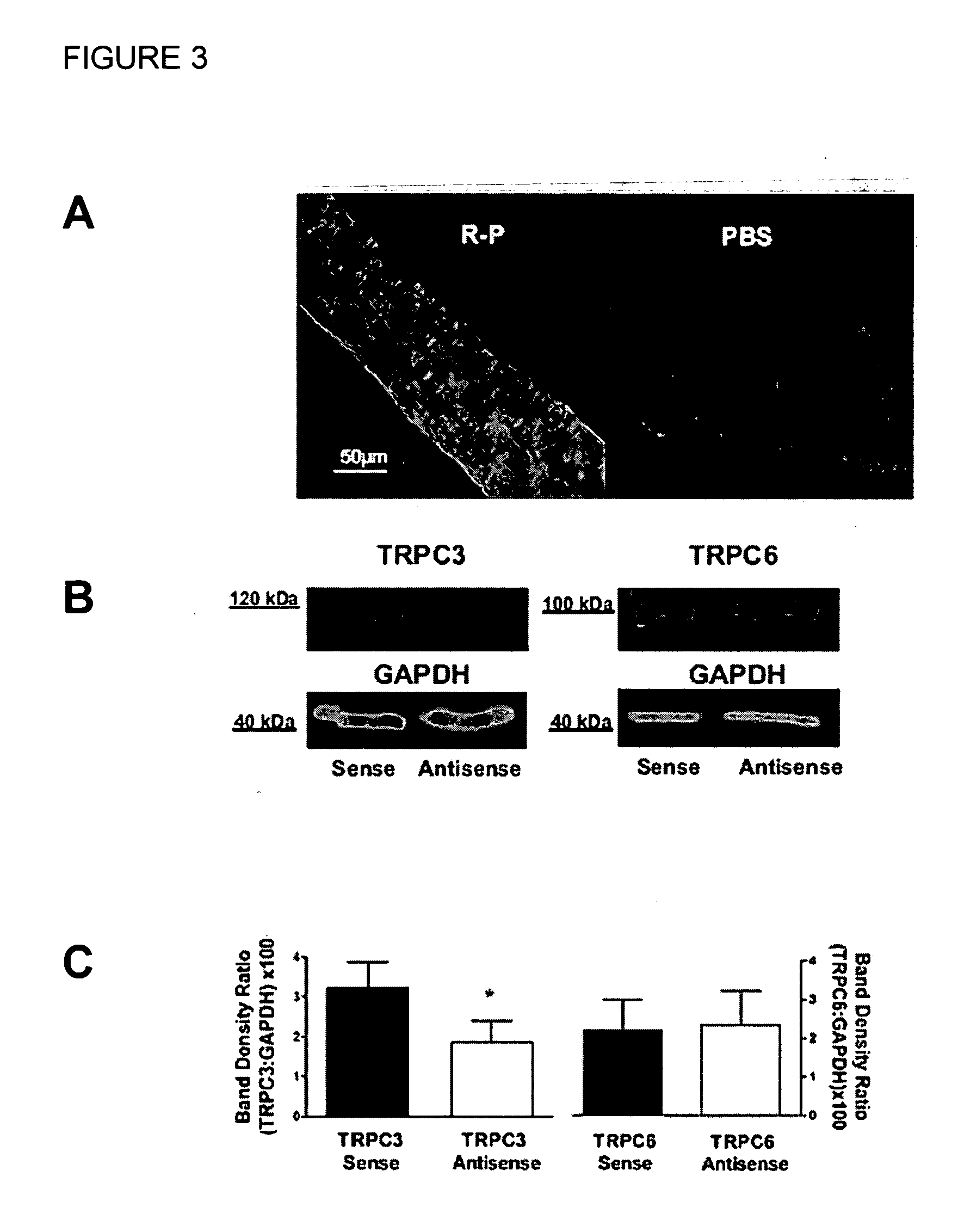 Methods and products for treating hypertension by modulation of TRPC3 channel activity