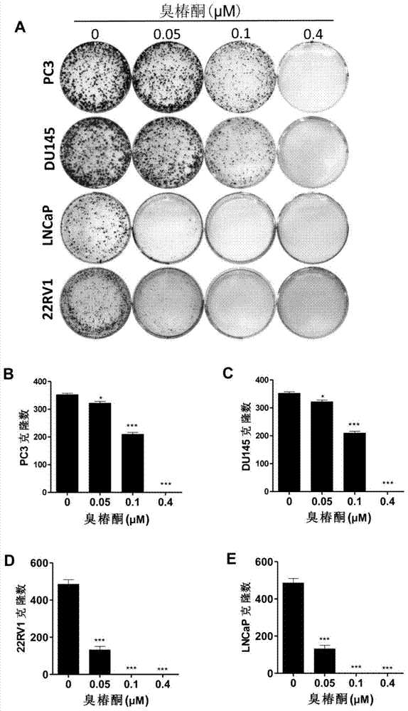 Application of ailanthonone in preparation of medicine for treating prostate disease