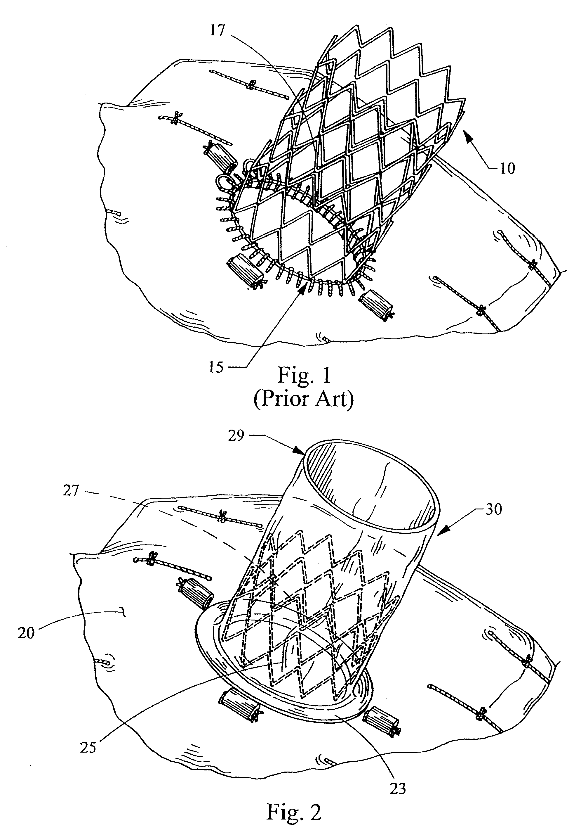 Socket For Fenestrated Tubular Prosthesis