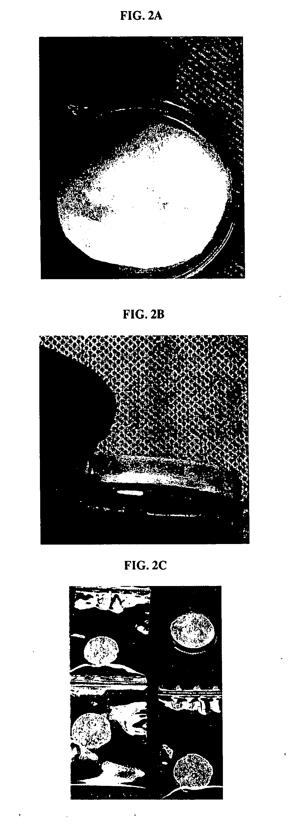 Muscle-based grafts/implants