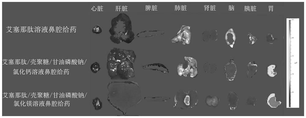 A kind of exenatide nasal cavity administration preparation and preparation method thereof