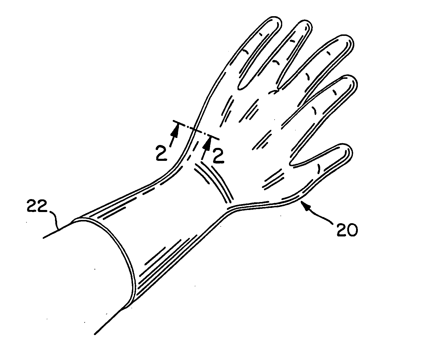 Method for forming an elastomeric article